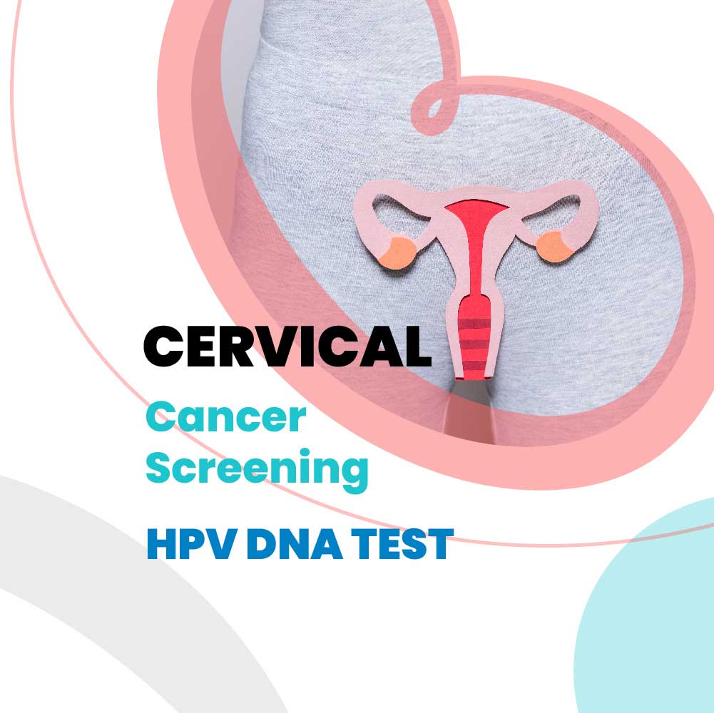 Cervical Cancer Screening HPV DNA Test