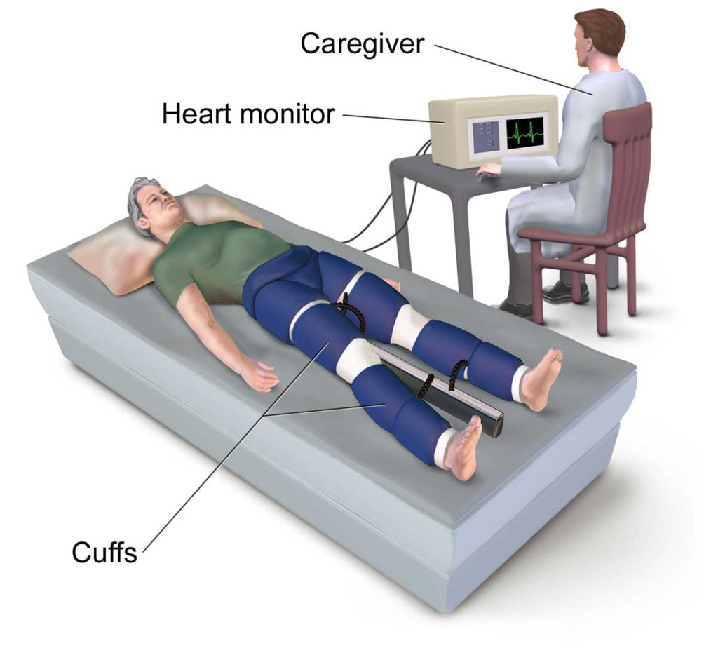 EECP Cardiac Therapy