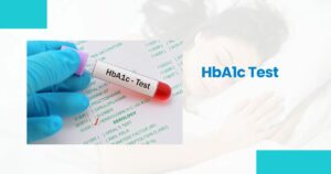 HbA1c Blood Test