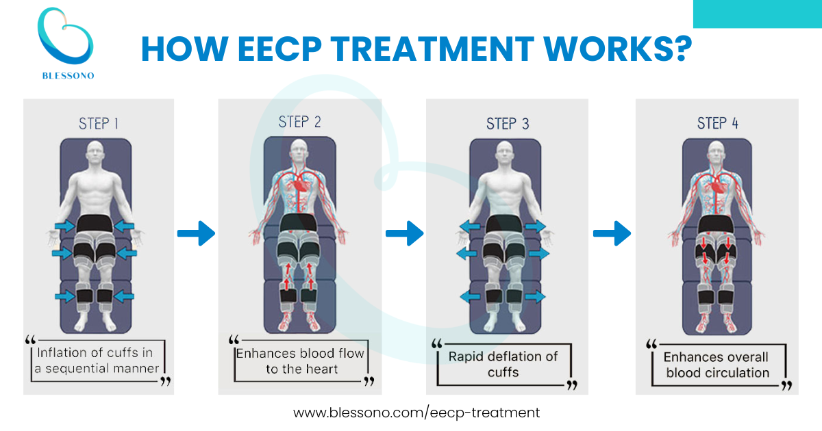 How EECP Treatment Works