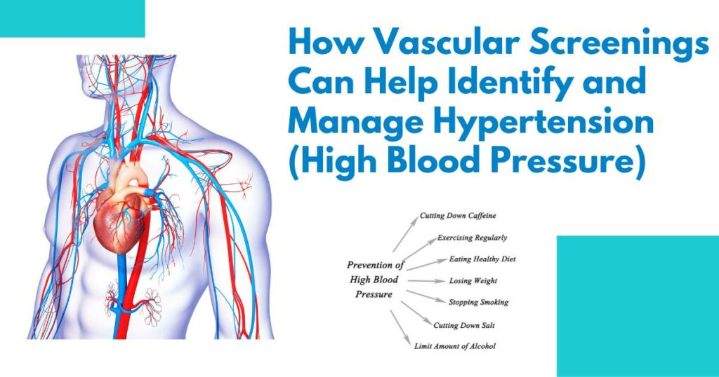 How Vascular Screenings Can Help Identify and Manage Hypertension (High Blood Pressure)