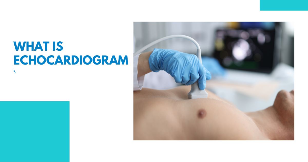 What is Echocardiogram